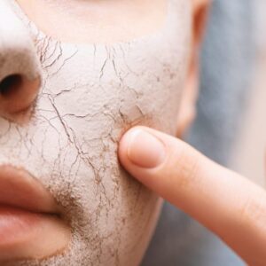 Webinar : Totalna biologia - trądzik i inne choroby skóry